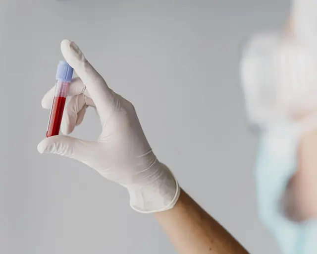 Mano con guante sostiene un tubo de muestra de sangre