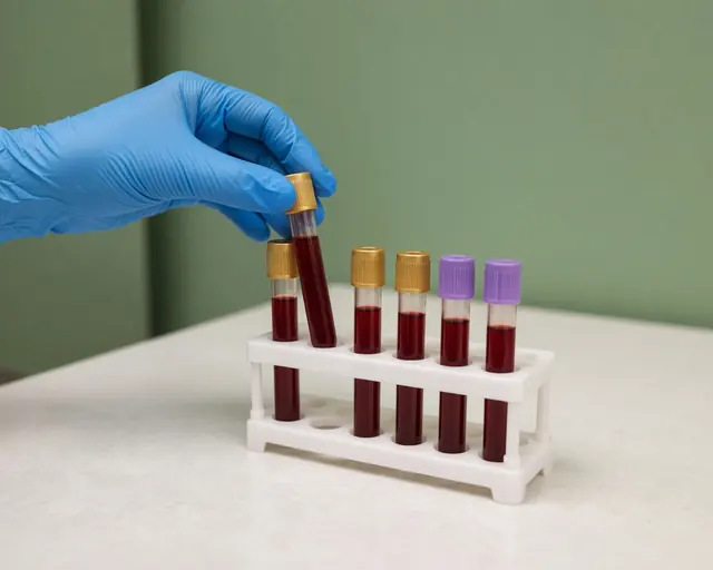 Tubos de muestras de sangre en una gradilla de laboratorio