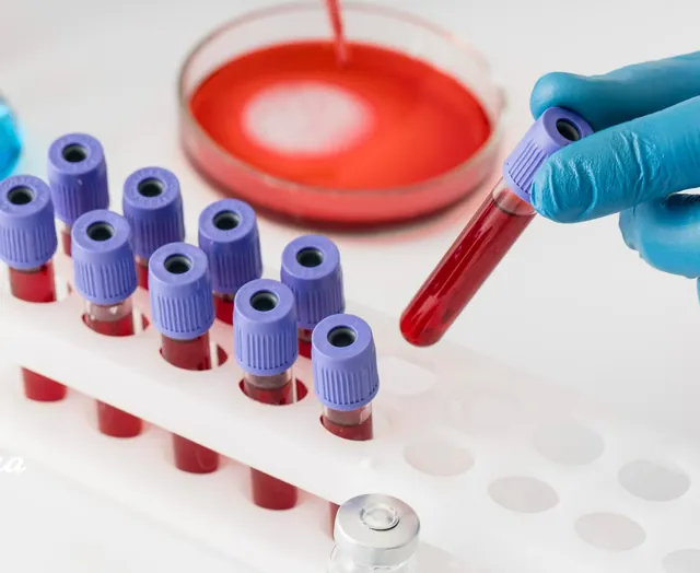 Tubos de muestras de sangre en el laboratorio